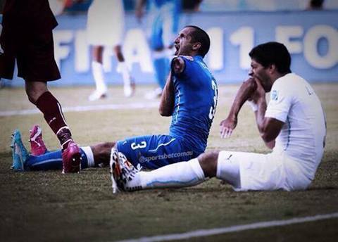 Suarez_Eating_A_Players_Hand.jpg